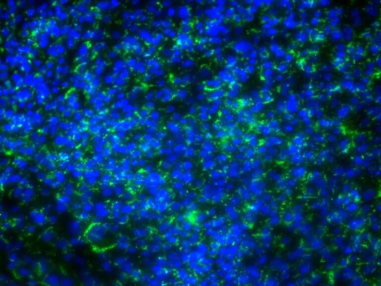 Fluorescence images of bovine cells following adipogenic differentiation. Intracellular lipid droplets were stained in green (BODIPY) and cell nuclei in blue (DAPI)