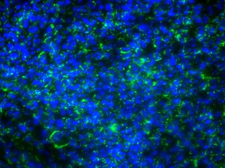 Fluoreszenzbilder von rinderzellen nach adipogener differenzierung. Intrazelluläre lipidtröpfchen wurden grün (bodipy) und zellkerne blau (dapi) angefärbt / © celltec systems